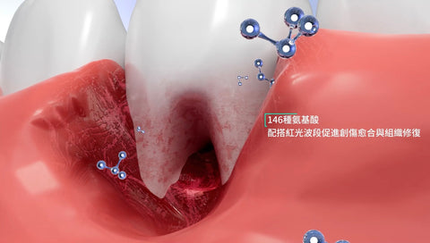 New Smile LED 第五代增量版納米護牙美白組合